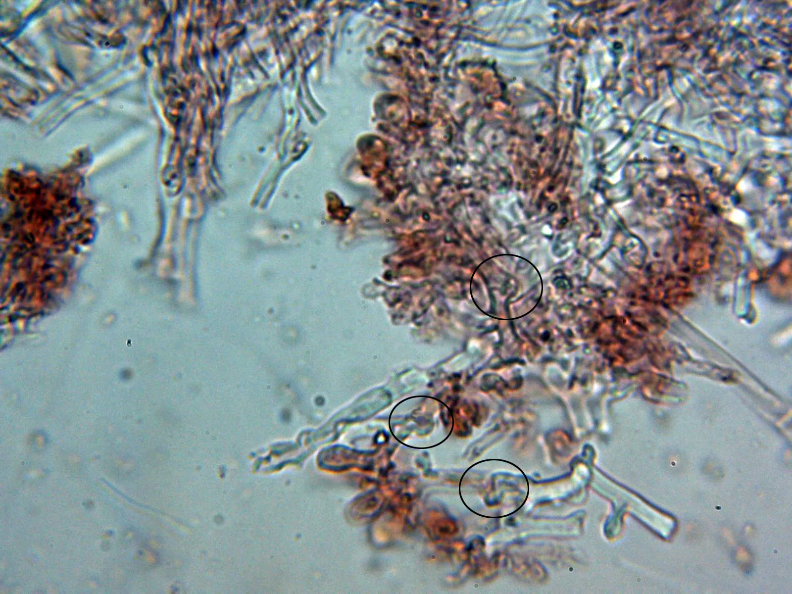 Microscopía de Trechispora kavinioides - 10 - Septos